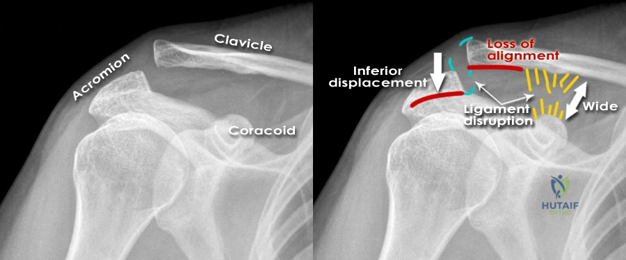 Clinical Image
