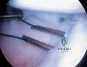 Clinical Image