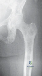 Clinical Image