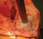 Clinical Image