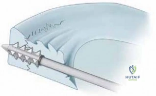 Clinical Image