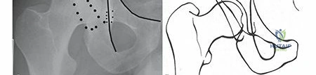 Clinical Image
