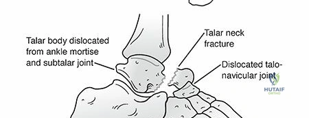 Clinical Image