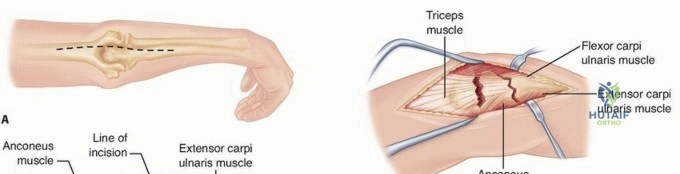 Clinical Image