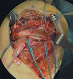 Clinical Image