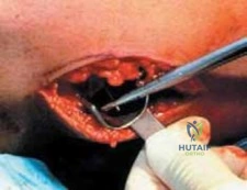 Clinical Image