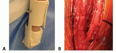 Clinical Image