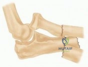 Clinical Image