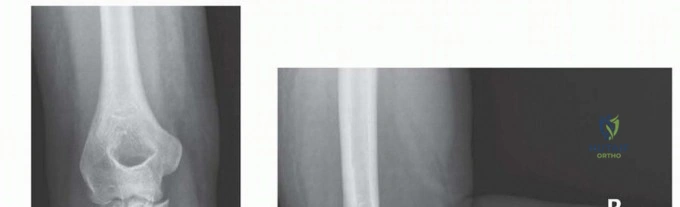Clinical Image