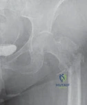 Clinical Image