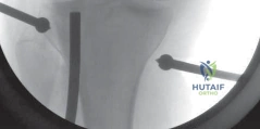 Clinical Image