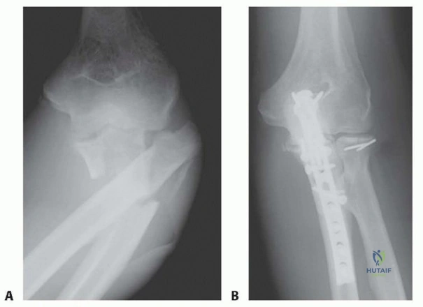 Clinical Image