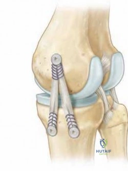 Clinical Image