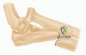 Clinical Image