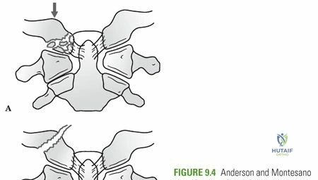Clinical Image