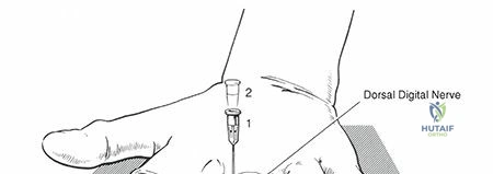 Clinical Image