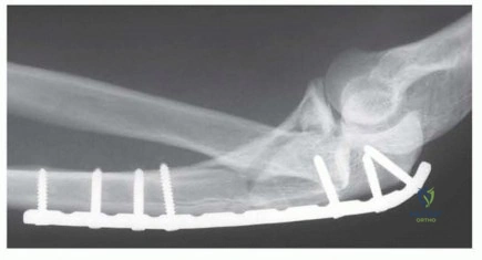 Clinical Image