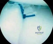 Clinical Image