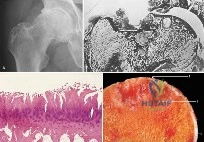 Clinical Image