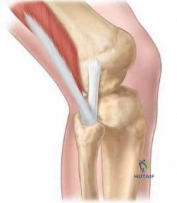 Clinical Image