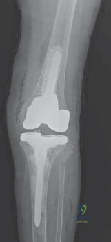 Clinical Image