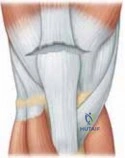 Clinical Image