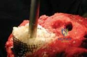 Clinical Image