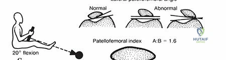 Clinical Image