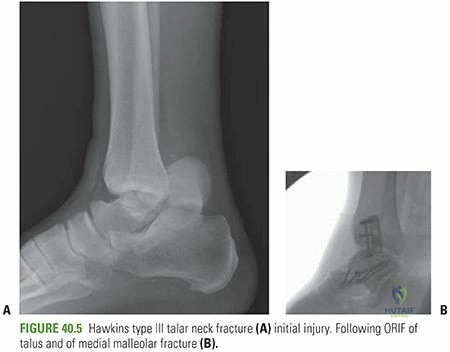 Clinical Image
