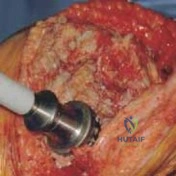 Clinical Image