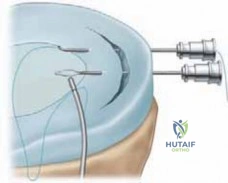 Clinical Image