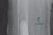 Clinical Image