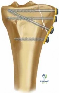 Clinical Image