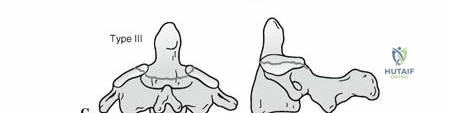 Clinical Image