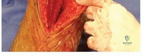 Clinical Image