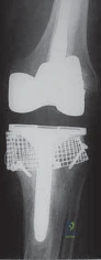 Clinical Image
