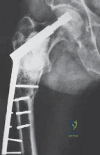 Clinical Image