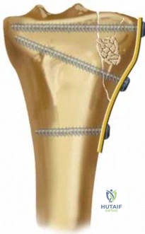 Clinical Image