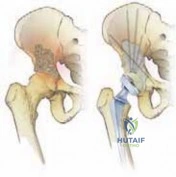 Clinical Image