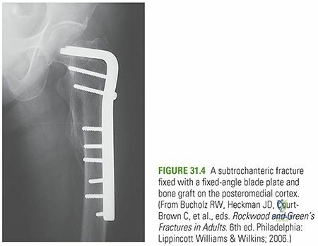 Clinical Image