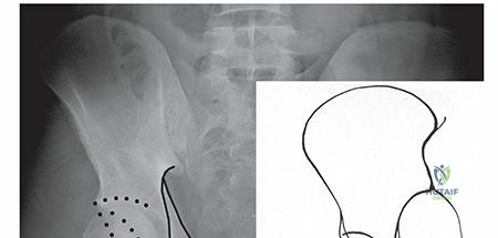 Clinical Image