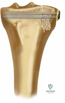 Clinical Image