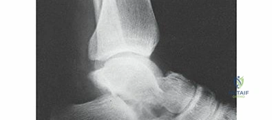 Clinical Image