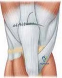 Clinical Image