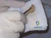 Clinical Image