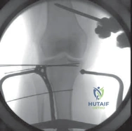 Clinical Image