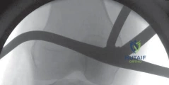 Clinical Image