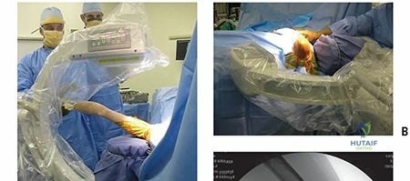 Clinical Image