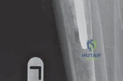 Clinical Image