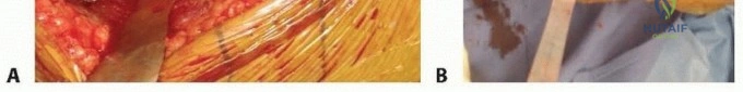 Clinical Image